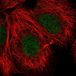 anti-NCBP1, Polyclonal, Novus Biologicals 0.1 mL | Buy Online | Novus Biologicals | Fisher Scientific